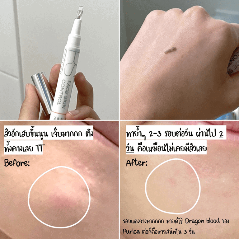 riviera suisse face skin control review 8
